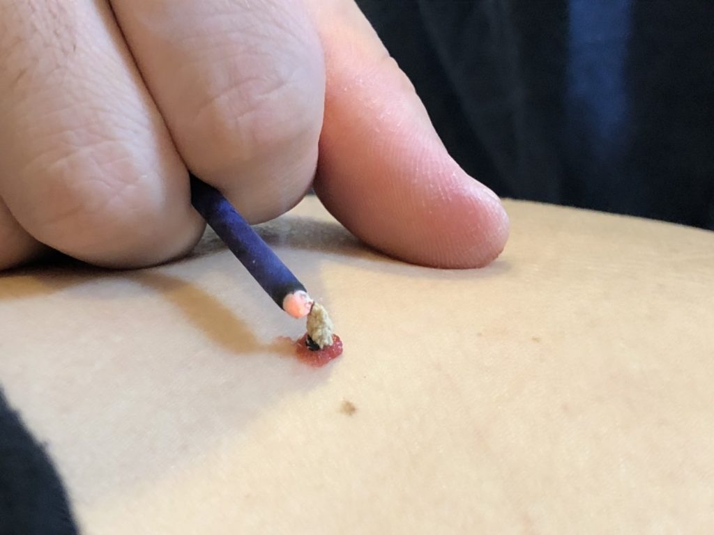 湘南オーガニックスタジオの鍼灸マッサージコース