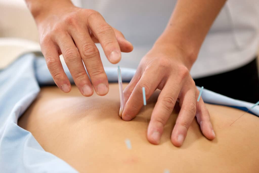 湘南オーガニックスタジオの鍼灸治療